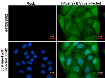 Anti-Influenza B virus Nucleoprotein antibody [GT371] used in Immunocytochemistry/ Immunofluorescence (ICC/IF). GTX629882
